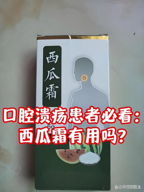 儿童口腔溃疡能用西瓜霜吗？-第2张图片-中州医学会