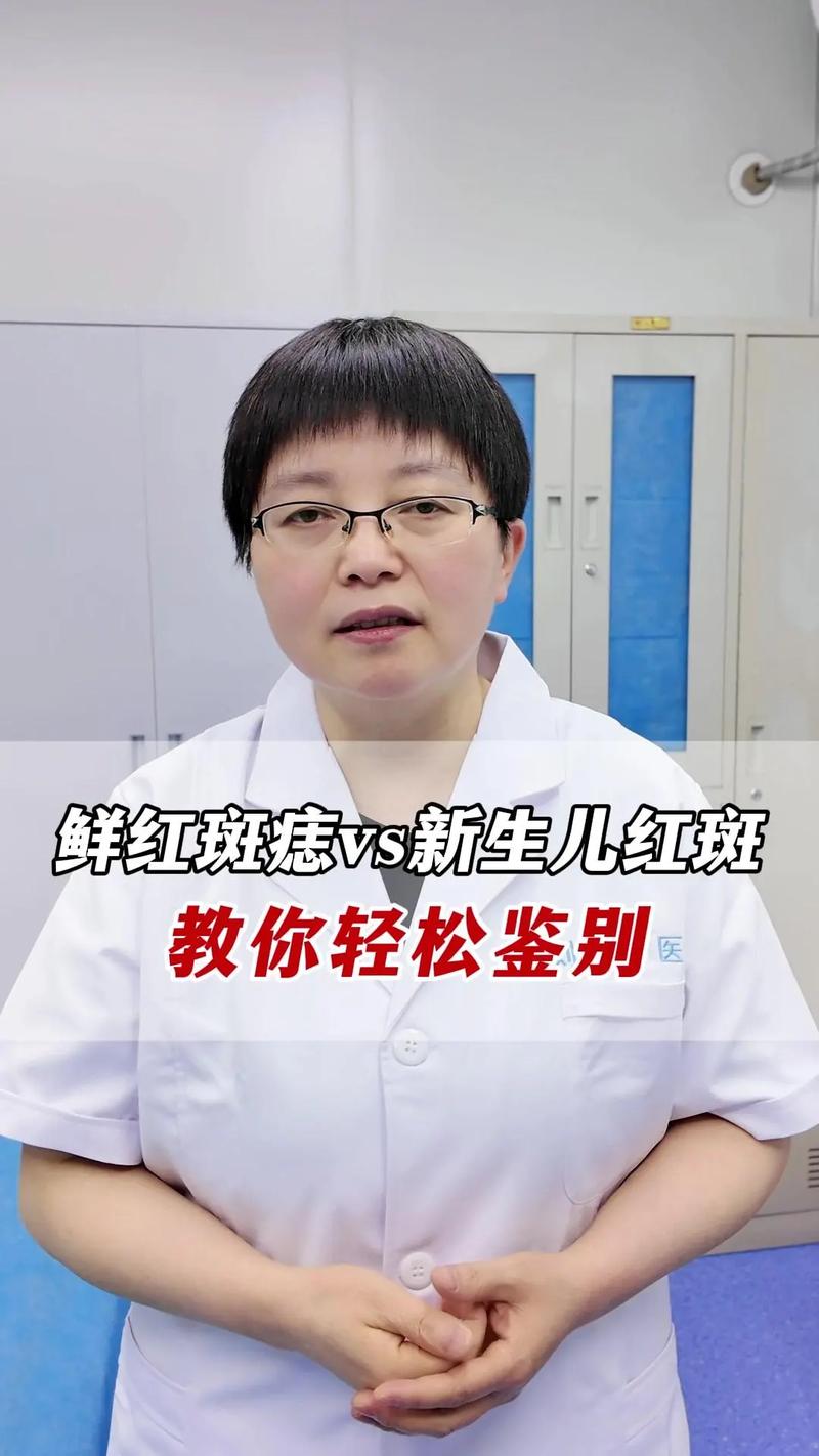 新生儿斑痣和鲜红斑痣有何不同？-第1张图片-中州医学会