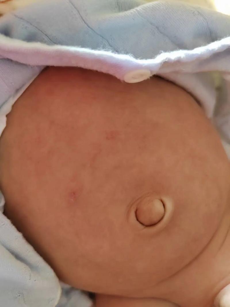 新生儿肚子总咕噜响是正常还是消化问题？-第1张图片-中州医学会