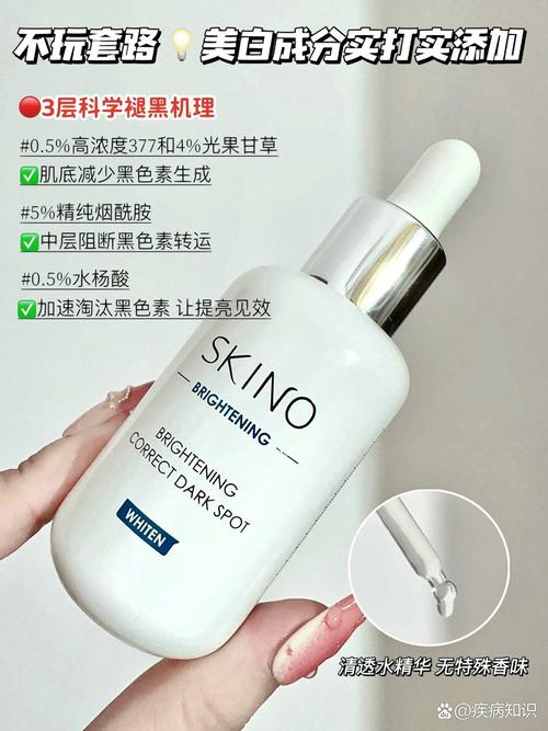 儿童雀斑因何而起?-第1张图片-中州医学会 儿童雀斑因何而起?-第1张图片-中州医学会