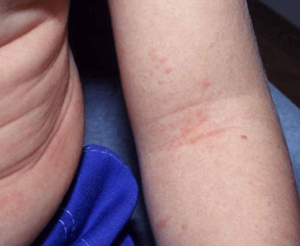 儿童免疫系统疾病早期症状-第2张图片-中州医学会 儿童免疫系统疾病早期症状-第2张图片-中州医学会