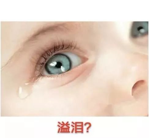 新生儿眼屎多怎么办？需清理或就医？-第3张图片-中州医学会