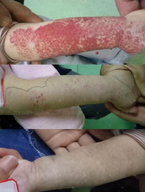 儿童血象高有哪些症状表现？-第1张图片-中州医学会