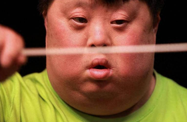 13岁智力低下有哪些具体表现？-第2张图片-中州医学会