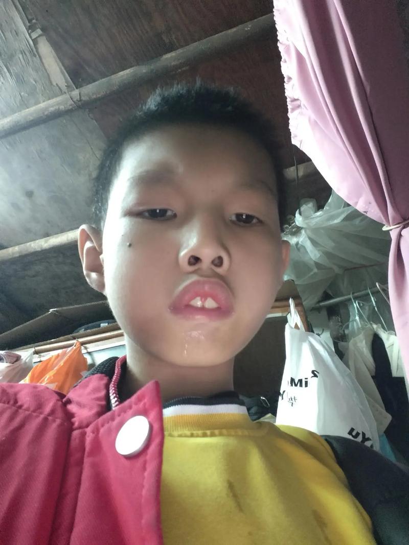 13岁智力低下有哪些具体表现？-第1张图片-中州医学会