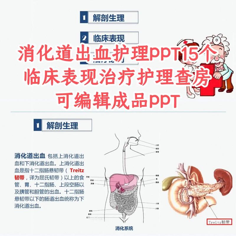 儿童消化道出血，治疗方案如何选择？-第2张图片-中州医学会