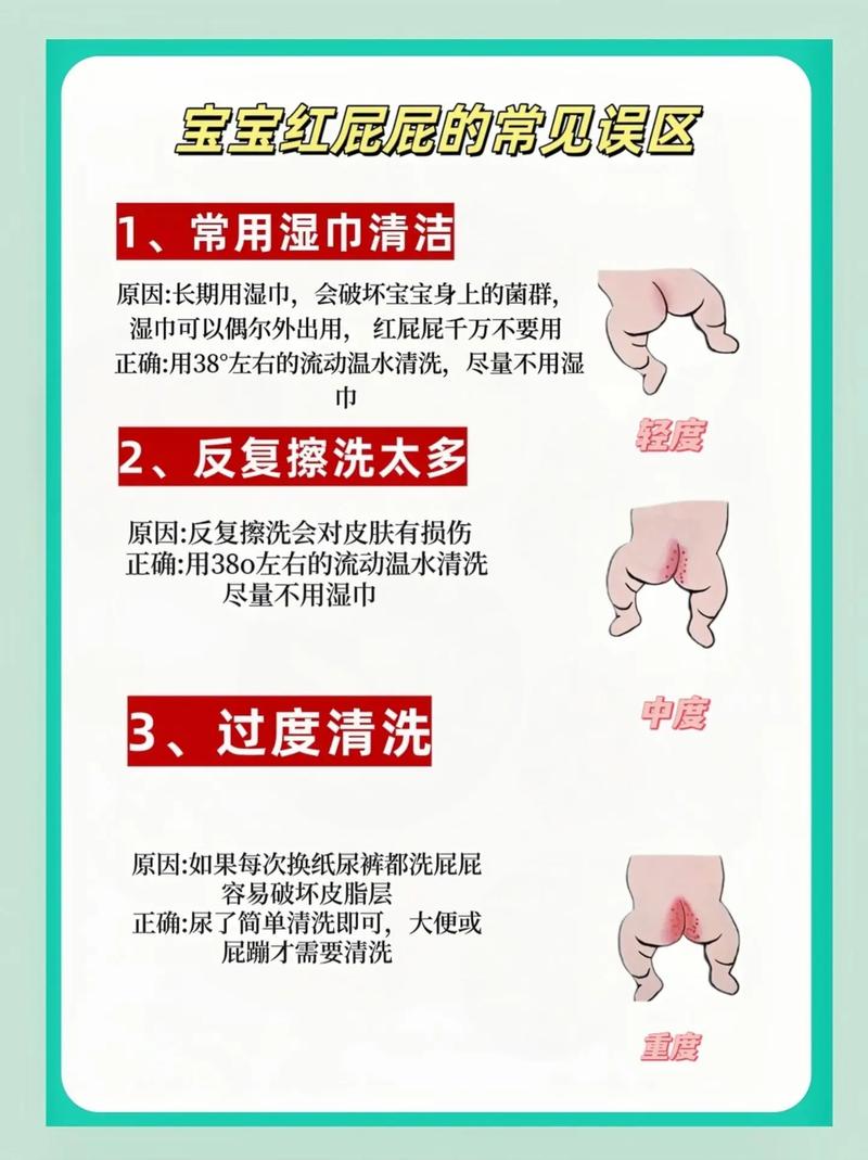 儿童肛门痒，是哪些原因引起的？-第3张图片-中州医学会