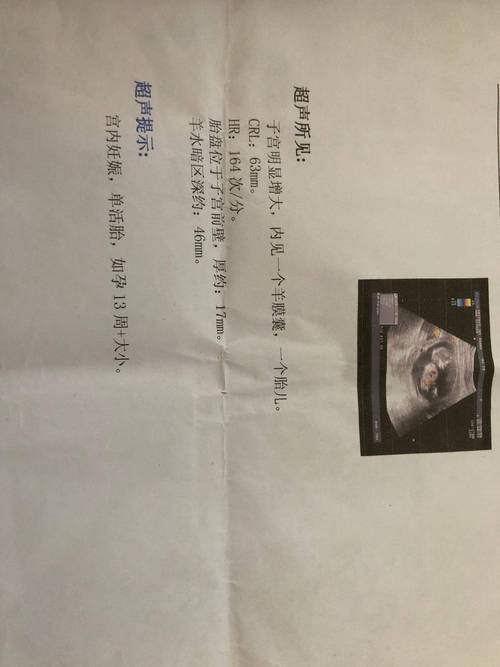 怀孕期间一共做几次b超-第3张图片-中州医学会