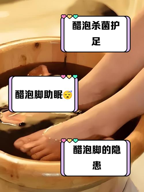 孕期醋泡脚安全吗？-第2张图片-中州医学会