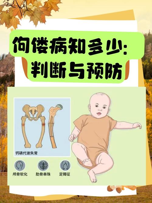 儿童佝偻病是缺啥造成的？-第2张图片-中州医学会