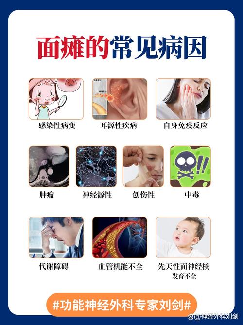 儿童面瘫诱因有哪些？-第2张图片-中州医学会