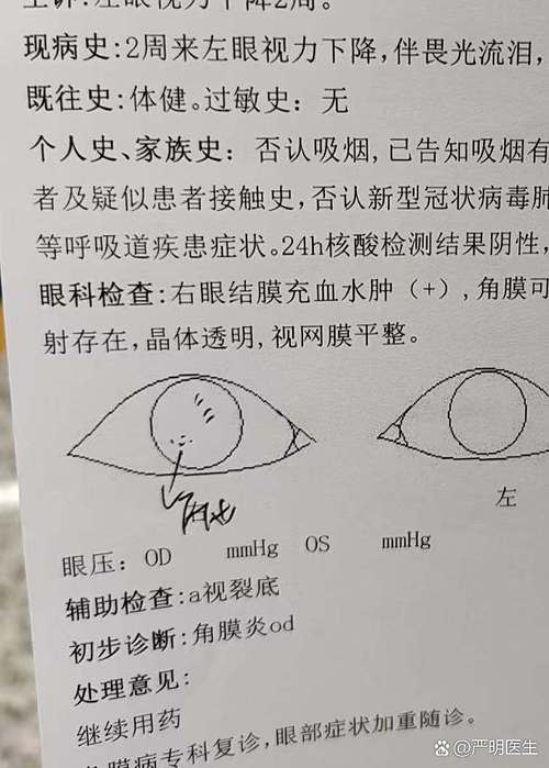 怀孕期间能戴隐形眼镜吗-第1张图片-中州医学会