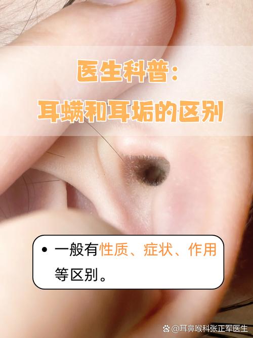 新生儿耳朵黑毛是异常吗？-第3张图片-中州医学会