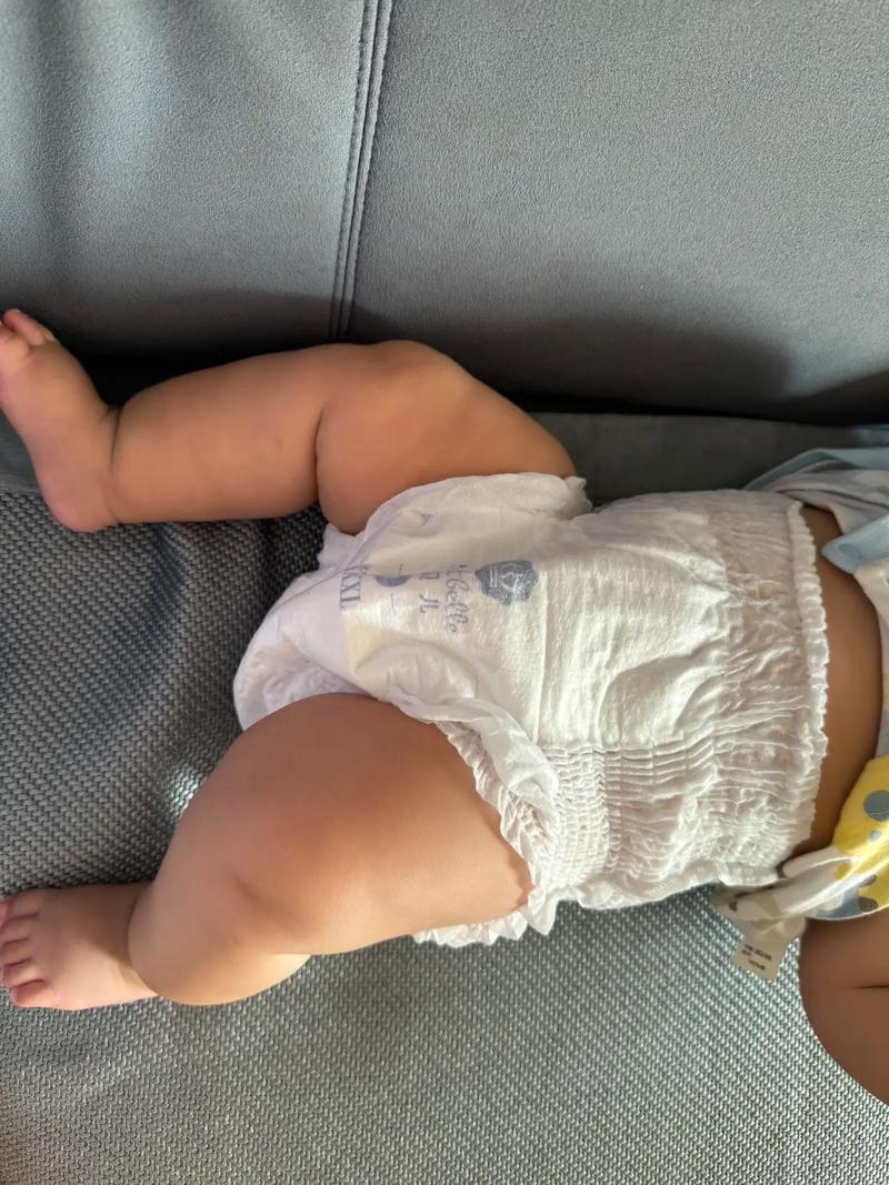 新生儿用尿不湿会不会罗圈腿-第3张图片-中州医学会