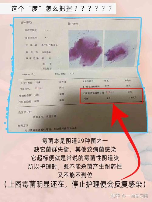 孕期白带清洁度三度怎么办？-第2张图片-中州医学会