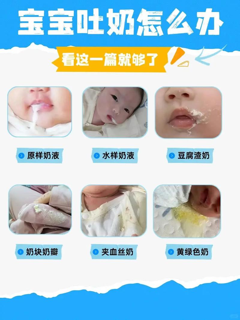 新生儿吸奶呼吸急促鼻塞怎么办？-第2张图片-中州医学会