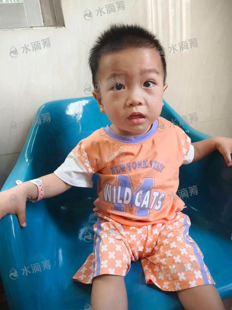 儿童急性白血病早期症状有哪些？-第1张图片-中州医学会