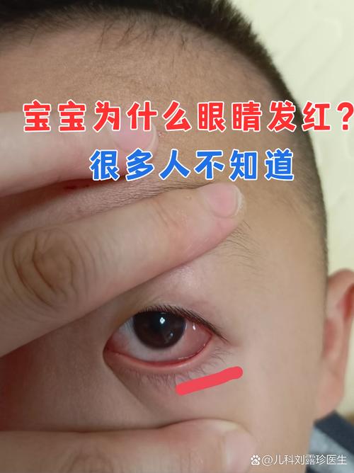 新生儿眼底血管几周能发育好？-第3张图片-中州医学会