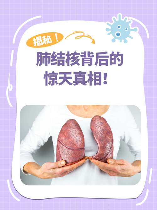 孕期患肺结核，胎儿健康怎么办？-第1张图片-中州医学会