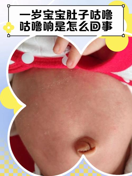 新生儿睡觉咯咯咯声是正常现象吗？-第2张图片-中州医学会