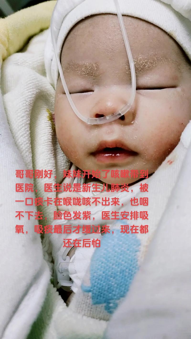 新生儿吸氧为何易伤眼？-第3张图片-中州医学会