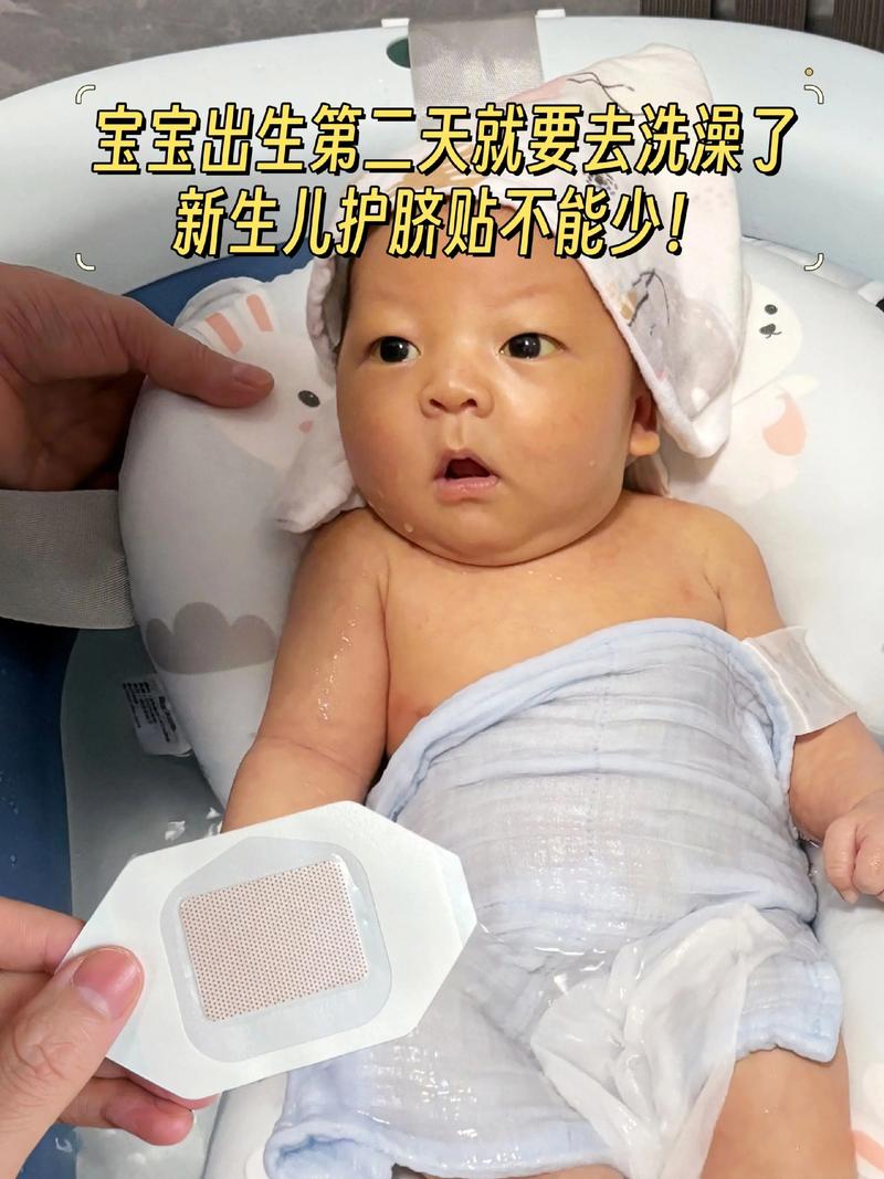 新生儿肚脐红肿是感染吗？-第2张图片-中州医学会