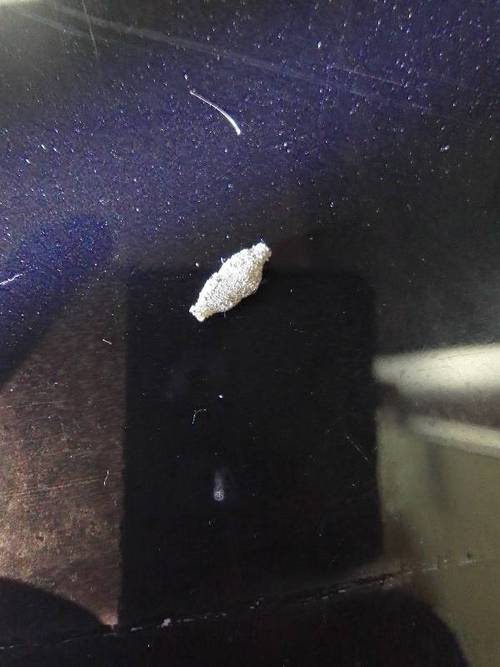 新生儿肚脐里的黑色是啥？-第3张图片-中州医学会