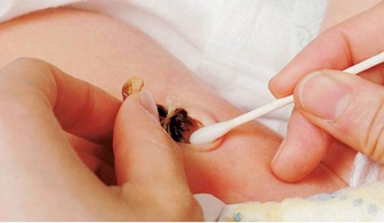 脐带脱落前能洗澡吗？-第1张图片-中州医学会