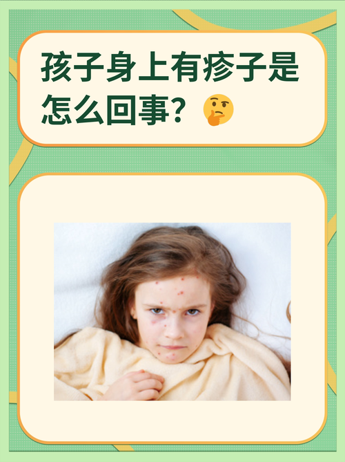 儿童免疫缺陷病有哪些症状？-第2张图片-中州医学会