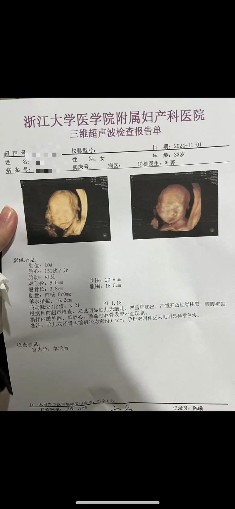 孕期三维彩超什么时候做-第2张图片-中州医学会