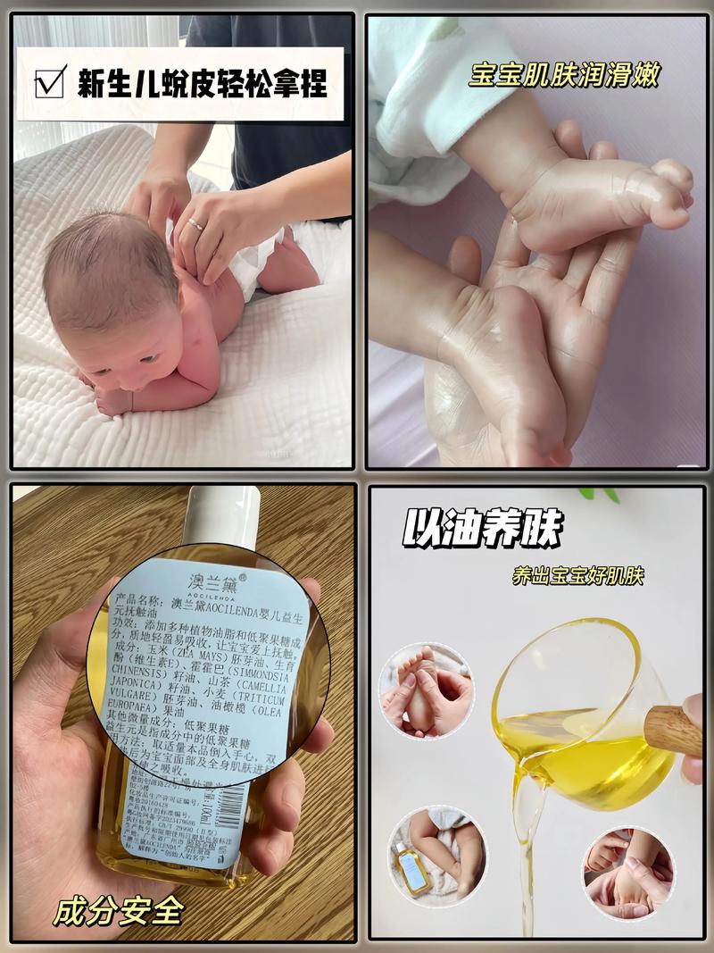 新生儿手脚脱皮需要抹东西吗-第2张图片-中州医学会