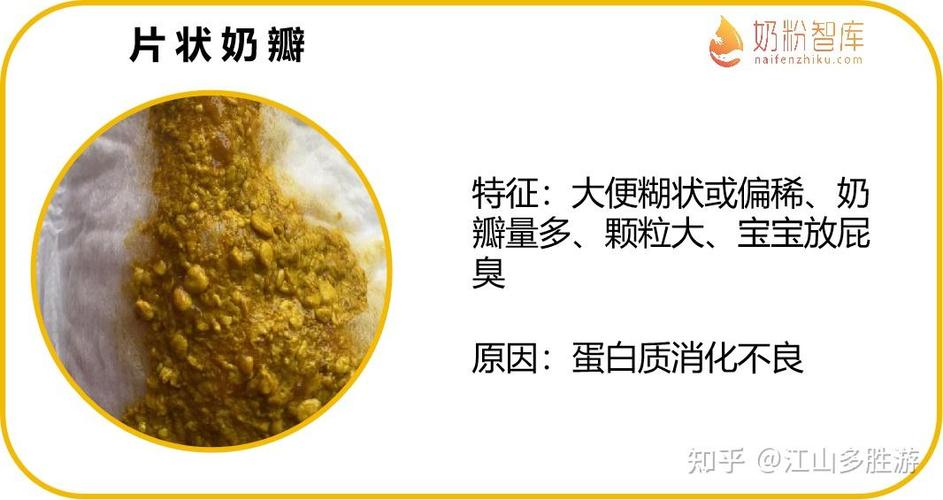 新生儿频繁换奶粉，影响健康吗？-第2张图片-中州医学会