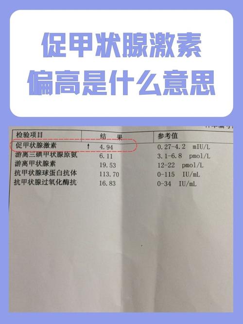 新生儿促甲状腺激素偏高，原因何在？-第3张图片-中州医学会