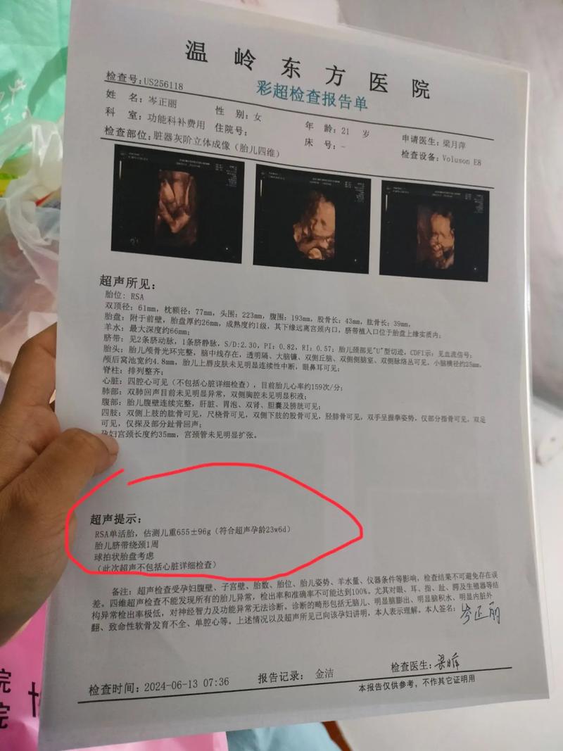 脐带绕颈一周危险吗？需注意什么？-第2张图片-中州医学会