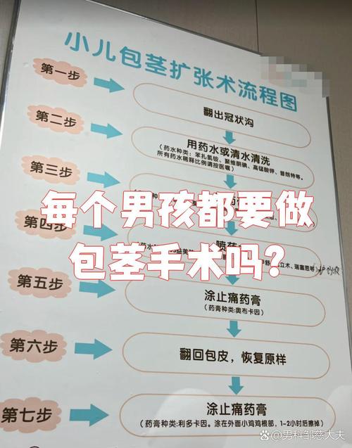 儿童包茎手术必须住院吗？-第2张图片-中州医学会