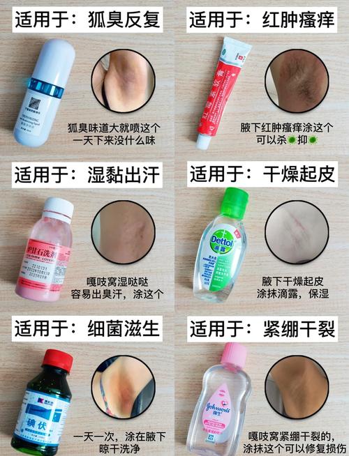 儿童腋臭最有效治疗法是手术吗？-第3张图片-中州医学会