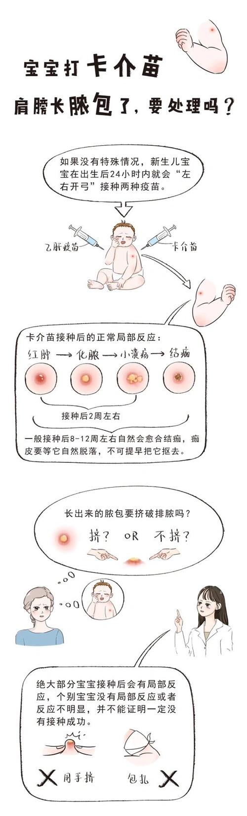 新生儿打卡介苗后有哪些常见反应？-第3张图片-中州医学会