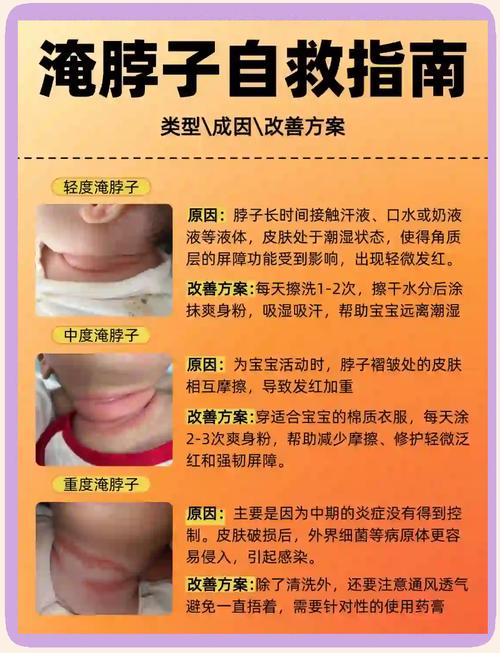 新生儿脖子淹破皮，如何正确护理处理？-第2张图片-中州医学会