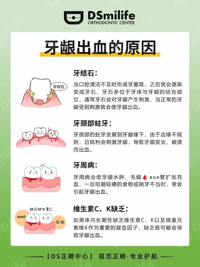 孕期牙龈出血咋办？-第1张图片-中州医学会