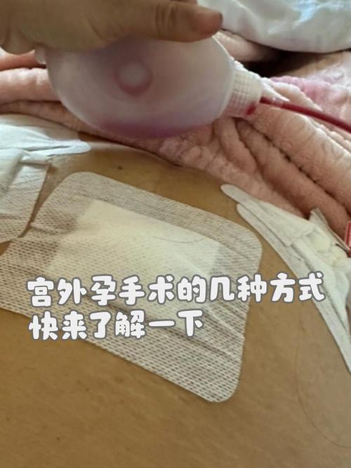 怀孕期间家里打孔有影响吗？-第2张图片-中州医学会