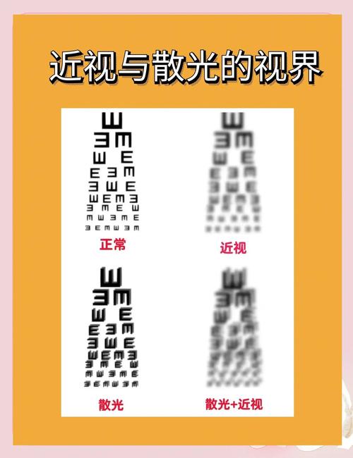 儿童散光300度能自愈吗？-第3张图片-中州医学会