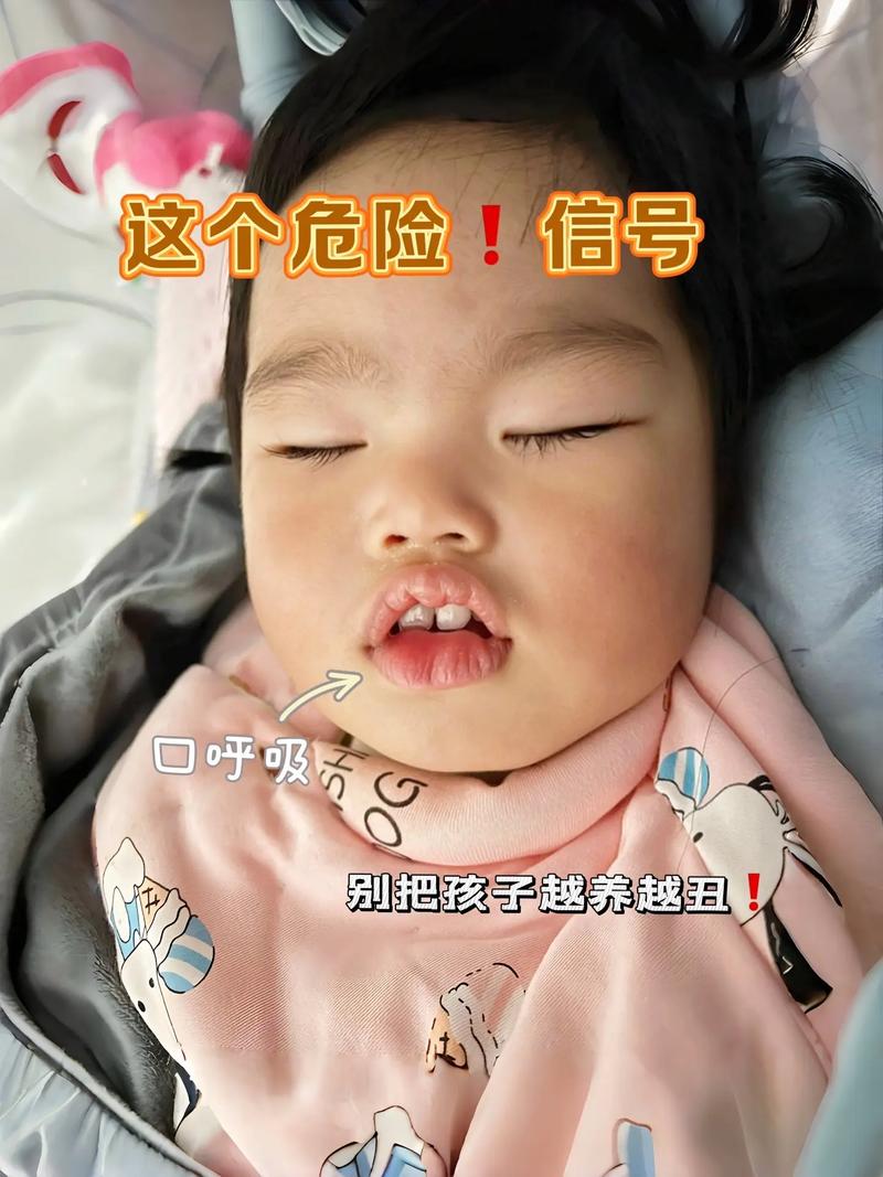 新生儿喝水呛紫怎么办？-第2张图片-中州医学会