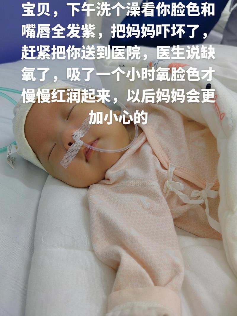 新生儿喝水呛紫怎么办？-第3张图片-中州医学会