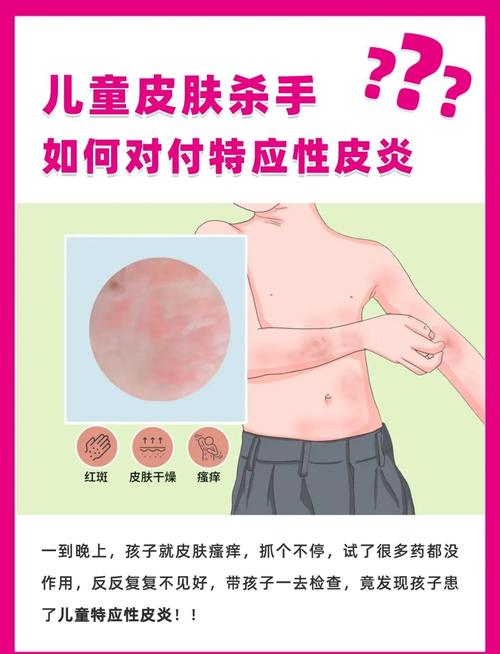儿童皮肤干燥瘙痒是何原因导致？-第3张图片-中州医学会