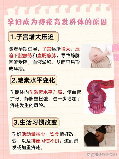 孕期痔疮犯了怎么办？-第2张图片-中州医学会