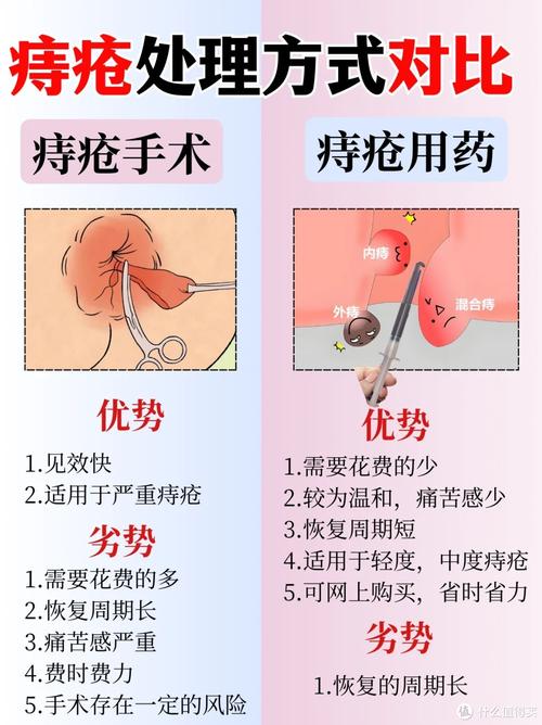 孕期痔疮犯了怎么办？-第3张图片-中州医学会