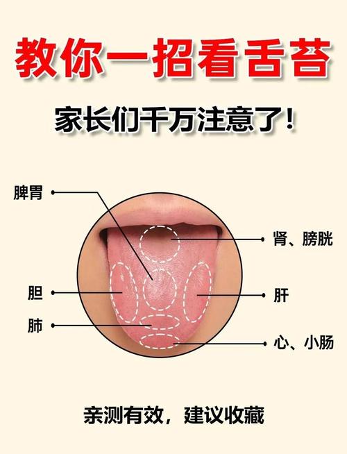 儿童舌苔厚黄最快处理办法是什么？-第1张图片-中州医学会