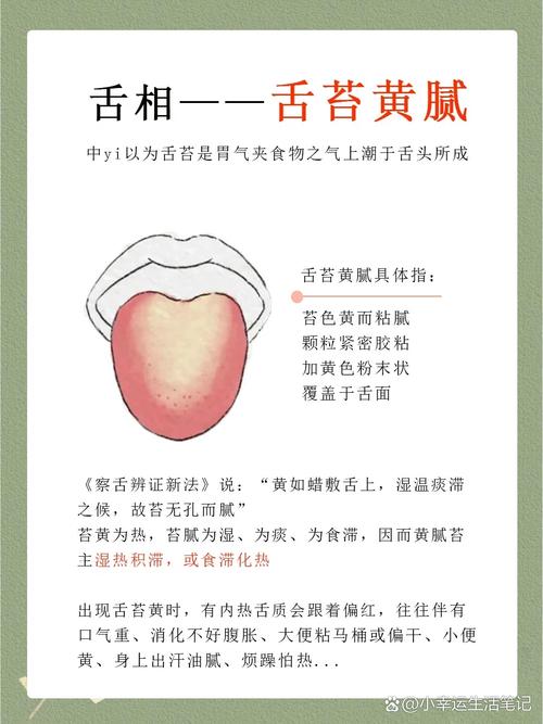 儿童舌苔厚黄最快处理办法是什么？-第3张图片-中州医学会