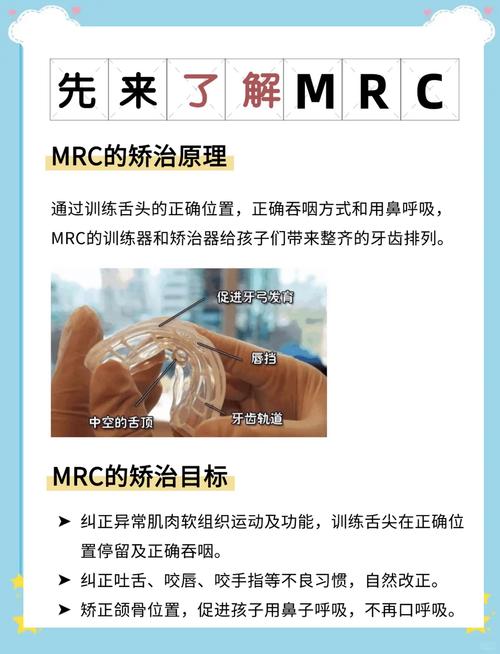 儿童MRC矫正怎么做？-第1张图片-中州医学会