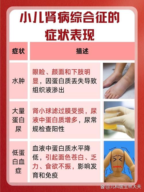 儿童肾炎早期症状有哪些？-第2张图片-中州医学会